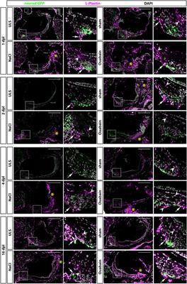 Reactivation of the Neurogenic Niche in the Adult Zebrafish Statoacoustic Ganglion Following a Mechanical Lesion